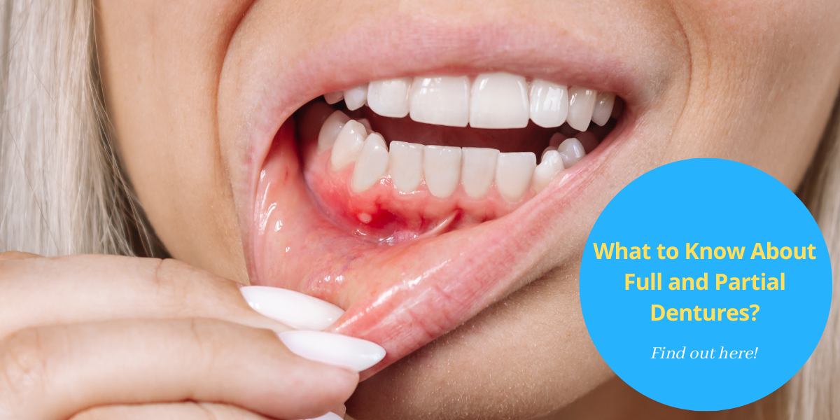 Why You Shouldn’t Ignore Bleeding Gums?