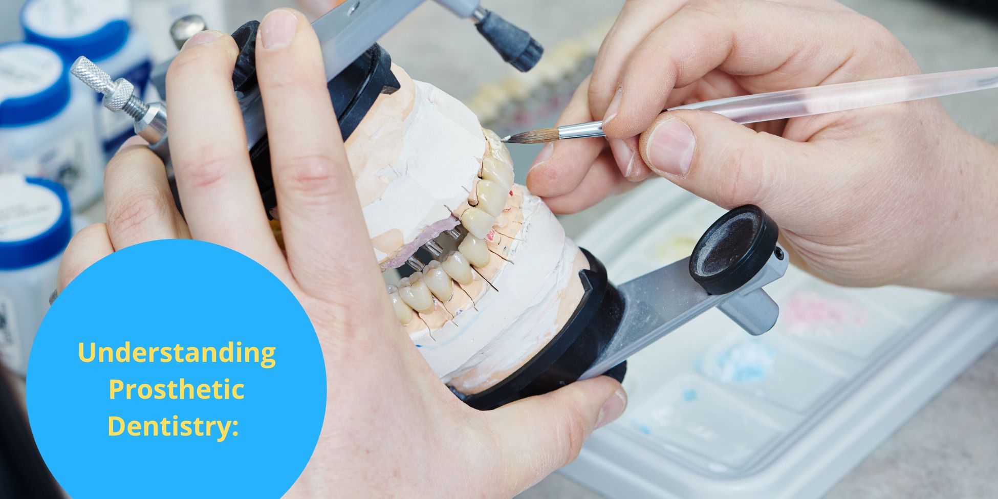 Understanding Prosthetic Dentistry: : What to Expect